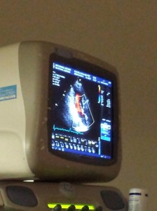 57999_20140529_091416_display